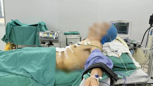 Thách thức trong ca mổ ung thư dạ dày, bệnh nhân 'nửa nằm nửa ngồi' 