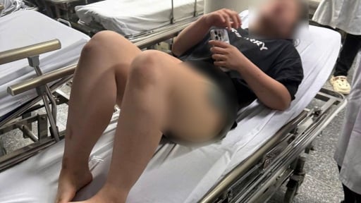 Cô gái trẻ bị nhóm người đánh hội đồng dã man trong đêm ở Hà Nội