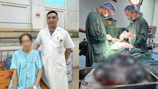 Phẫu thuật th&agrave;nh c&ocirc;ng cắt khối u buồng trứng khổng lồ nặng 5kg cho người phụ nữ ở Quảng Trị