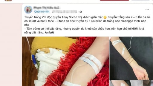 Hiểm họa từ dịch vụ l&agrave;m đẹp tại nh&agrave;: Đừng rước 'tai họa' v&igrave; ham tiện, ham rẻ