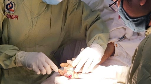 Thanh ni&ecirc;n 17 tuổi su&yacute;t đứt l&igrave;a 3 ng&oacute;n tay trong ng&agrave;y đầu đi l&agrave;m thợ mộc