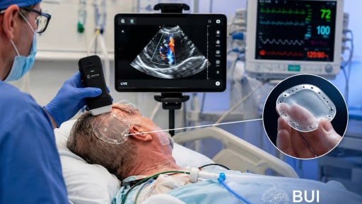 Giải m&atilde; c&ocirc;ng nghệ BUI: Bước ngoặt si&ecirc;u &acirc;m n&atilde;o chấm dứt kỷ nguy&ecirc;n phụ thuộc v&agrave;o CT v&agrave; MRI