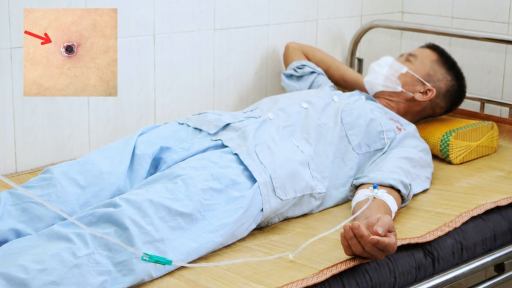 Suy kiệt v&igrave; sốt cao li&ecirc;n tục, r&eacute;t run 6 ng&agrave;y mới đi viện 