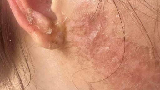 Khởi tố vụ chồng báo công an khi phát hiện vợ bắt nhốt người phụ nữ để đánh đập