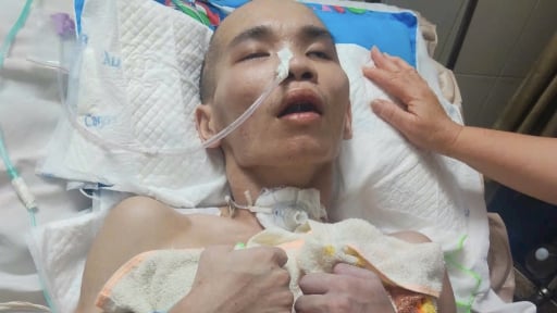 

Mẹ nhặt ve chai cầu cứu con trai khỏe mạnh sau chấn thương sọ não