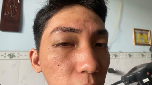 Mâu thuẫn giao thông trên đường, nam thanh niên bất ngờ bị những người hút hầm vệ sinh đấm, đá tới tấp phải nhập viện