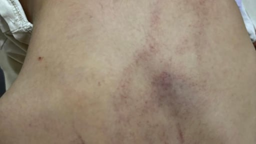 Thông tin mới nhất vụ giáo viên bạo hành trẻ ở Trường Mầm non Gia Thụy, Hà Nội: Sở GDĐT chỉ đạo 'nóng'