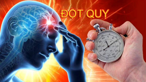 Đột quỵ não: Dấu hiệu nhận biết và cách phòng ngừa hiệu quả