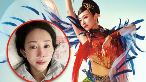 Nữ nghệ sĩ múa lên sân khấu dù đang điều trị ung thư