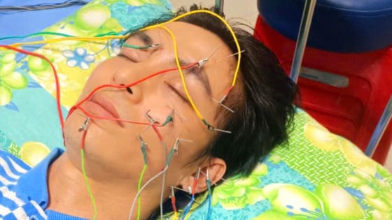 'Nam thần' điện ảnh Việt bất ngờ bị liệt dây thần kinh số 7, mặt đơ cứng sau khi rời Đà Lạt về TP.HCM