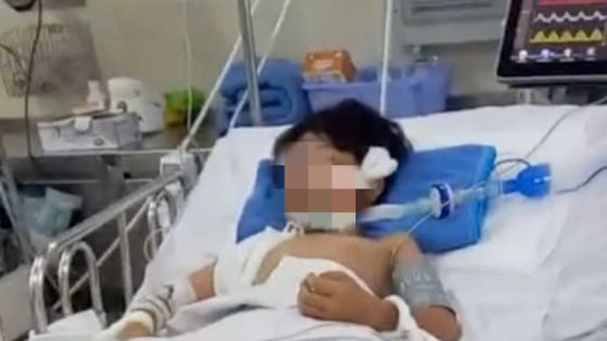 Dừng chờ đèn đỏ, bé trai 10 tuổi nguy kịch do bị cành cây khô rơi trúng đầu 