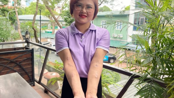 Chuyện những “chiến binh” mắc căn bệnh khiến cả cuộc đời không tiếp xúc với ánh mặt trời