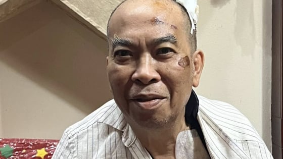 Thông tin mới nhất về sức khỏe của Chủ tịch Hội Nhà văn Việt Nam sau vụ tai nạn gãy xương