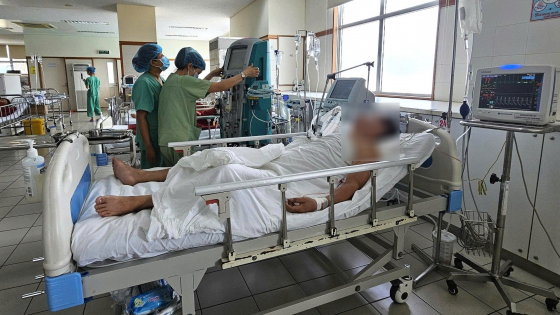 Sở Y tế TP Huế thông tin 42 ca mắc liên cầu lợn 