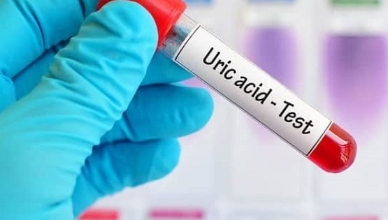 Lưu ngay các cách hạ axit uric an toàn, hiệu quả