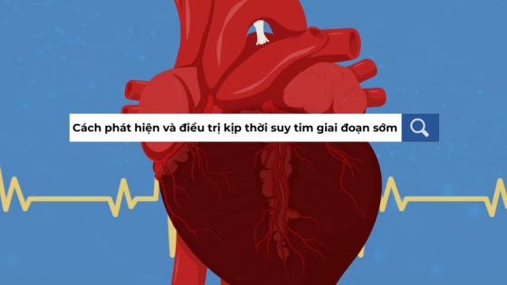 Suy tim giai đoạn sớm – Cách phát hiện và điều trị kịp thời