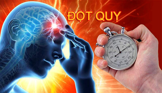 Đột quỵ não: Dấu hiệu nhận biết và cách phòng ngừa hiệu quả