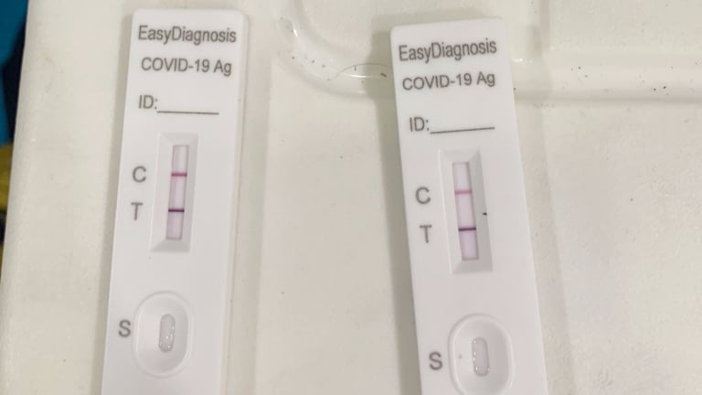Nghi ngờ mắc Covid-19, người dân có cần test nhanh không?