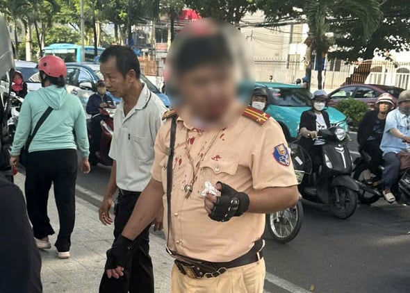 Một du khách nước ngoài tấn công CSGT ở Nha Trang khi đang làm nhiệm vụ