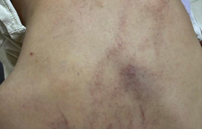 Vụ giáo viên bạo hành trẻ ở Trường Mầm non Gia Thụy, Hà Nội: Thêm 1 giáo viên bị tạm đình chỉ