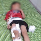 Ninh Bình: Bé trai 5 tuổi bị thương nặng vì ngã từ tầng 2 khách sạn