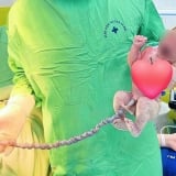 Kịp thời cứu sống trẻ sơ sinh có dây rốn dài bất thường, vặn xoắn nhiều vòng