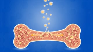Liệu pháp Ozone hỗ trợ điều trị chứng rối loạn xương