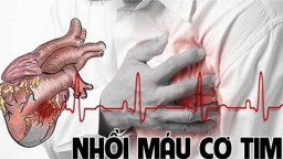 Phòng tránh bệnh nhồi máu cơ tim thế nào cho đúng?