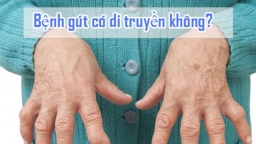 Bệnh nhân bị bệnh gout có di truyền được không?