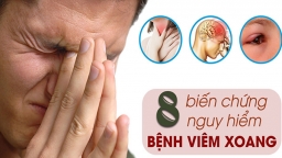 Các biến chứng nguy hiểm của viêm xoang mạn tính bạn cần biết