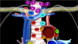 Phân biệt các trạm hạch bạch huyết của lồng ngực