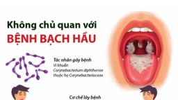 B.s Trường Dược Sài Gòn cảnh báo bệnh bạch hầu thông qua các triệu chứng