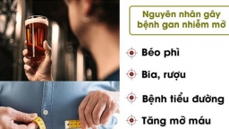 Cây thuốc Đông y nào điều trị hiệu quả bệnh gan nhiễm mỡ?