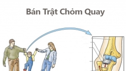 Nguy cơ bán trật chỏm quay khi kéo tay trẻ em