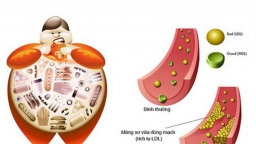 Dược sĩ chia sẻ thời điểm tốt nhất uống thuốc hạ mỡ máu