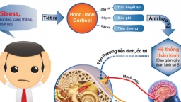 Chứng rối loạn tiền đình, làm thế nào để không tái phát?