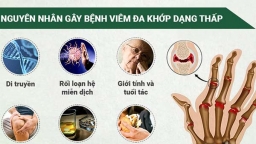 Bài thuốc Y học cổ truyền chữa viêm khớp dạng thấp