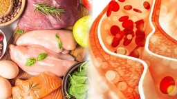 Những nhóm thực phẩm hỗ trợ kiểm soát cholesterol cao