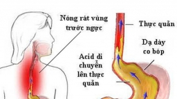 Tìm hiểu các nguyên nhân gây nên bệnh trào ngược dạ dày thực quản