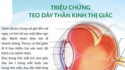 Những nguyên nhân bất thường gây nên bệnh teo dây thần kinh thị giác