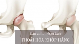 Bệnh thoái hóa khớp háng có các phương pháp điều trị nào?