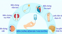 Bác sĩ Trường Dược Sài Gòn chia sẻ ba biến chứng của bệnh đái tháo đường