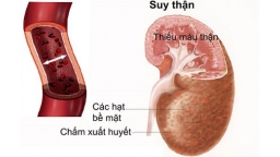 Tìm hiểu những nguyên nhân và triệu chứng của bệnh suy thận tại thận