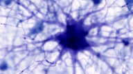 Trí tuệ nhân tạo mang đến hy vọng tìm ra phương pháp điều trị bệnh Alzheimer
