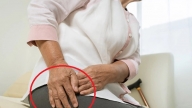 4 dấu hiệu cảnh báo viêm khớp háng ở người cao tuổi