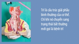 Bệnh trĩ và khuyến cáo của bác sĩ về dấu hiệu, biến chứng, cách điều trị