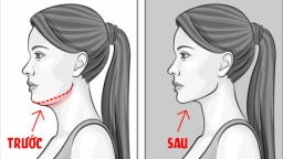 7 cách giảm mỡ mặt và loại bỏ hai cằm hiệu quả không cần phẫu thuật