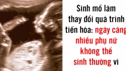 6 sự thay đổi ở cơ thể người cho thấy chúng ta vẫn đang tiến hóa