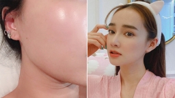 9 bí quyết giữ mãi làn da trẻ trung, kích thích sản xuất collagen tự nhiên chống lão hóa