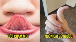 7 khả năng kỳ quái của con người không phải ai cũng làm được, bạn có sở hữu cái nào không?